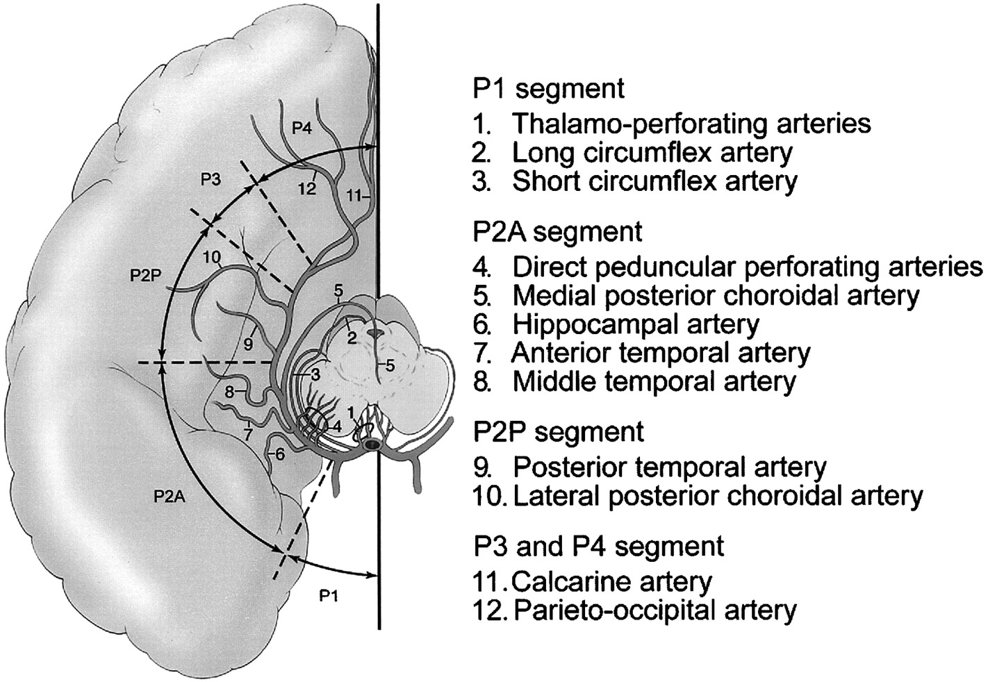 Pca Branches