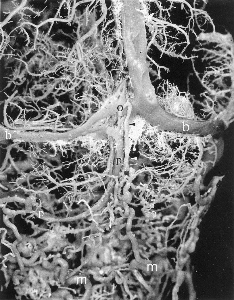 Transverse Cervical Vein