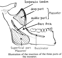 submasseteric space