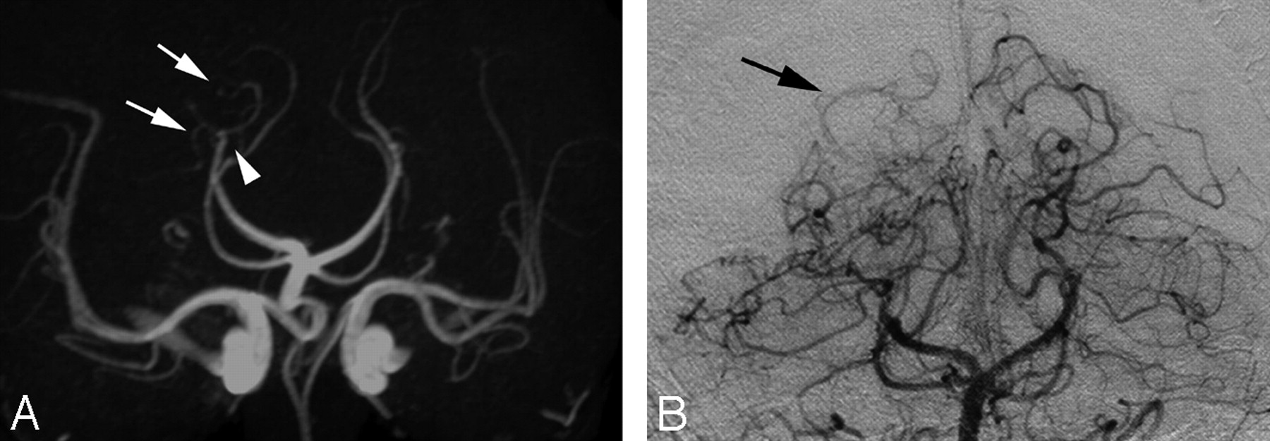 Pca Branches