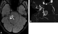 Fig 2.