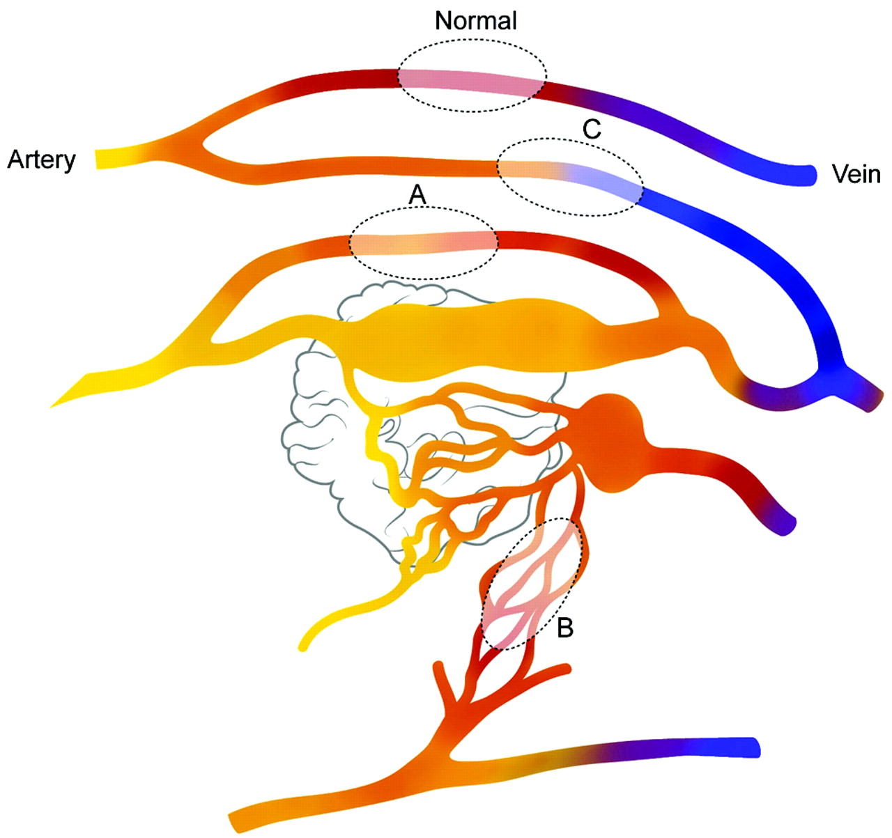 Artery System Diagram