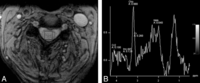 Fig 2.