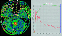 Fig 1.