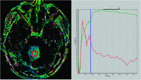 Fig 2.