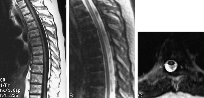 fig 1.