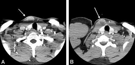 Fig 3.