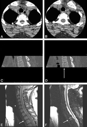 Fig 4.