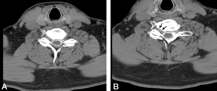 Fig 5.