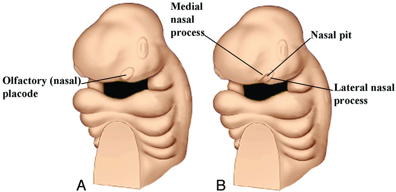 deep pit Facial cheek develops