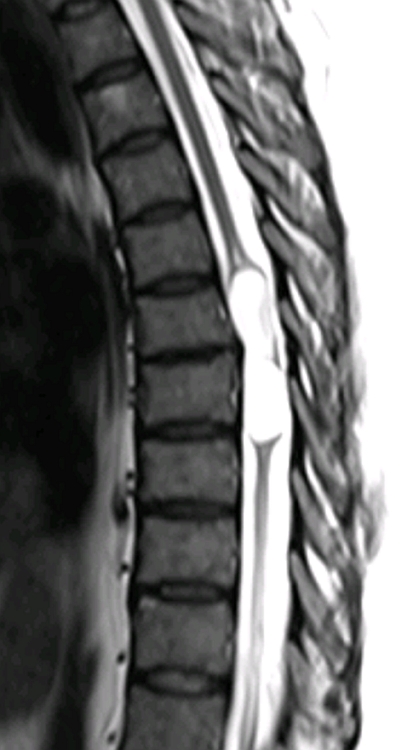 january-18-2016-case-of-the-week-american-journal-of-neuroradiology