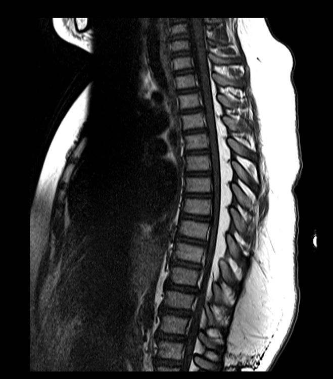 june-6-2019-case-of-the-week-american-journal-of-neuroradiology