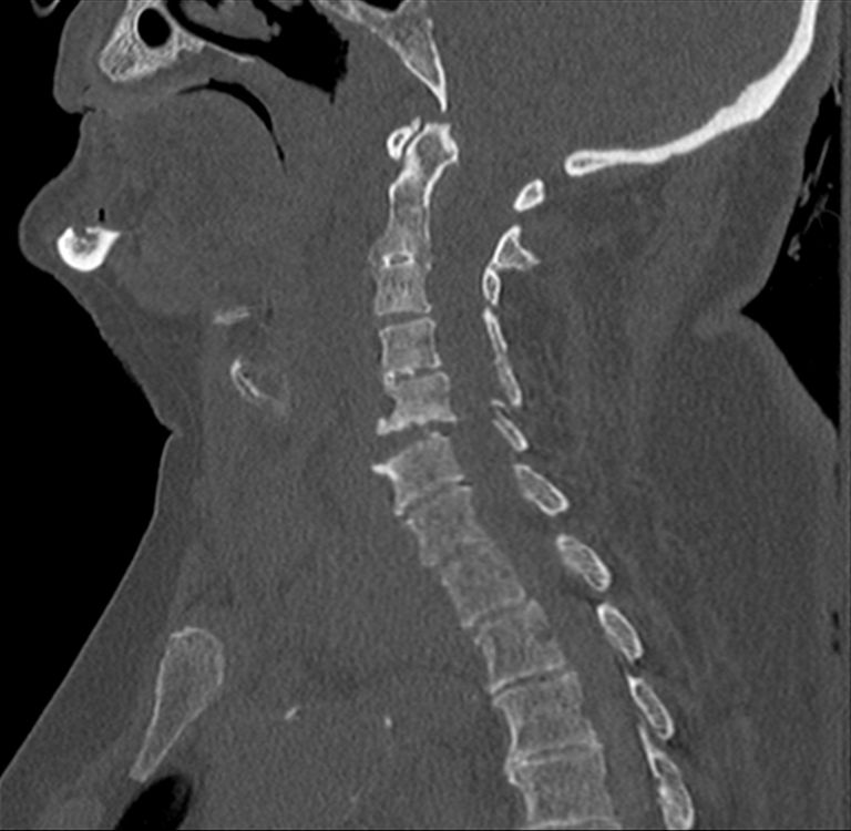 june-25-2020-case-of-the-week-american-journal-of-neuroradiology